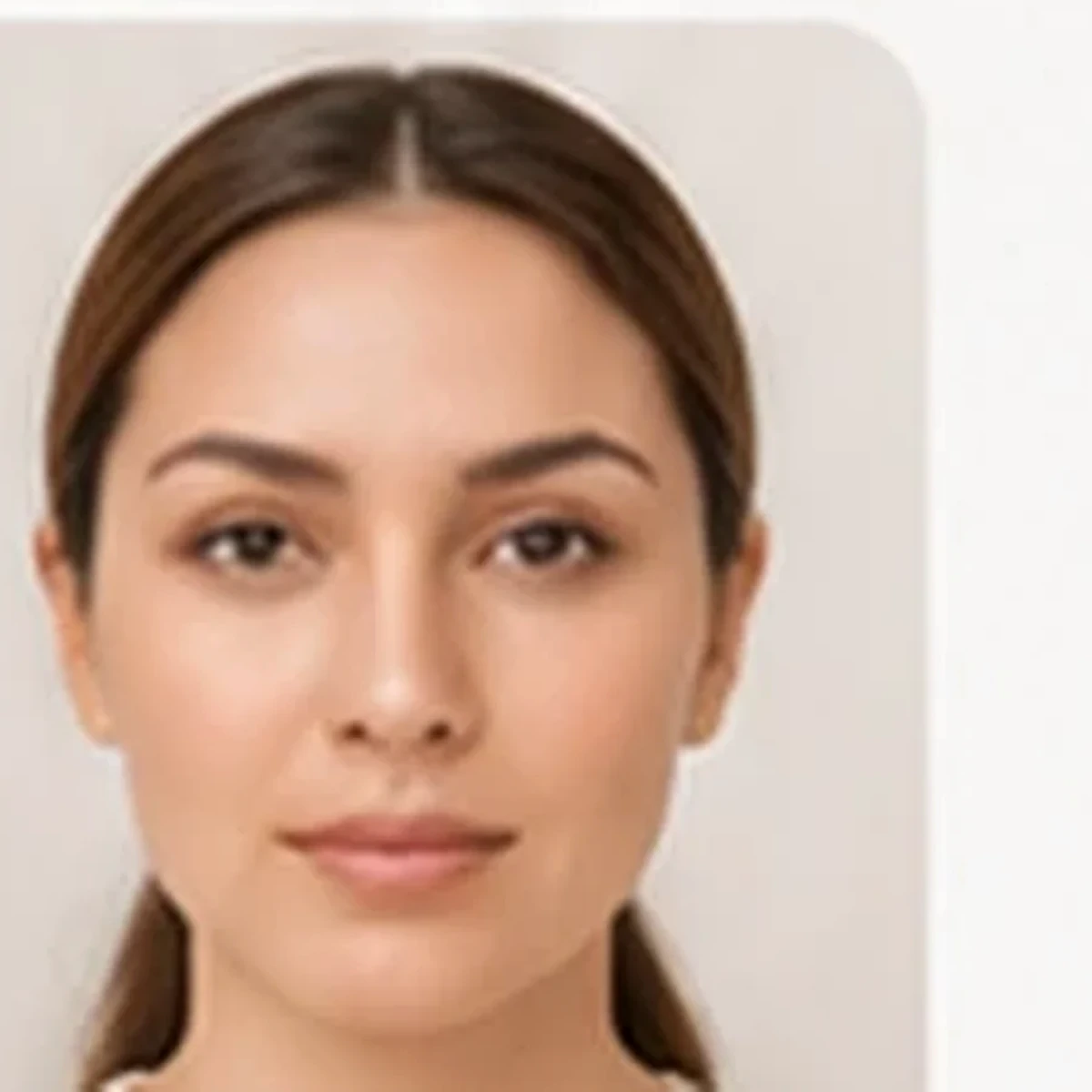 نمونه بعد از فیشیال و پاکسازی پوست
